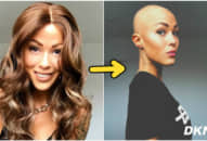 Cô bé 14 tuổi bị hói khiến bạn bè xa lánh, nhưng nhờ chiếc đầu trọc mà cô đã vô cùng thành công