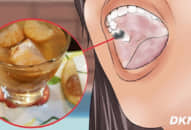 Bài thuốc quá dễ trị răng lung lay ê buốt, tới già răng vẫn không rụng