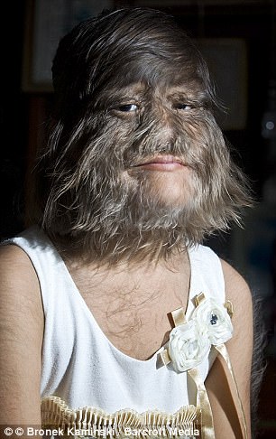 ‘Cô gái khỉ đột’ lần đầu cạo mặt gây bất ngờ với nhan sắc, treo status cùng chồng mới khiến ai cũng ngưỡng mộ