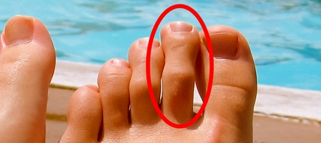 8 dấu hiệu cơ thể bạn đang ‘kêu khóc’ cầu cứu, đừng bỏ qua trước khi quá muộn!