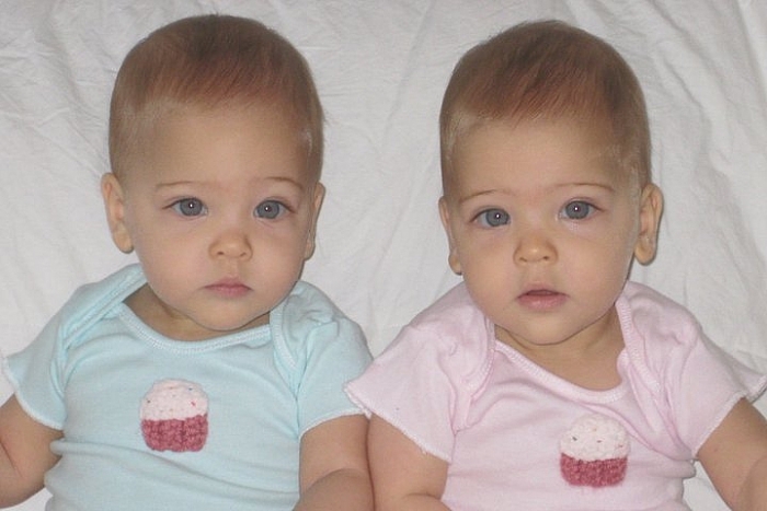 2 bé gái ra đời năm 2010, giờ họ được mệnh danh &#8216;Cặp song sinh đẹp nhất thế giới&#8217;, xem ảnh mới thấy quá xứng đáng