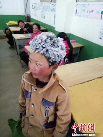 Đây là số tiền mà cậu bé tóc đóng băng, da tay nứt nẻ ở Trung Quốc được hỗ trợ, nhìn mà ấm lòng