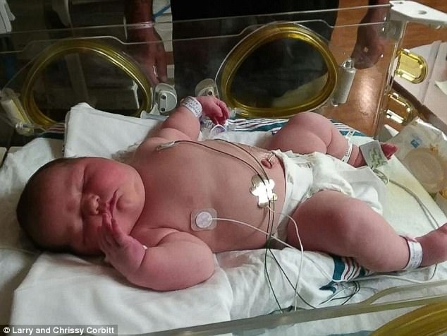 Cô mang thai đã đến ngày sinh nở, nhưng khi nhìn thấy em bé, không bác sĩ nào tin vào mắt mình