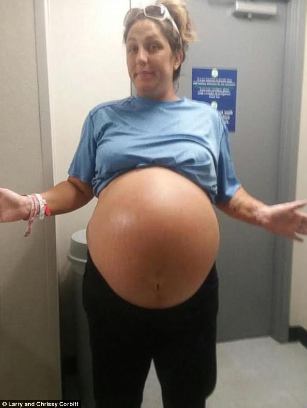 Cô mang thai đã đến ngày sinh nở, nhưng khi nhìn thấy em bé, không bác sĩ nào tin vào mắt mình
