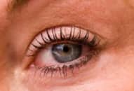 Đã có thuốc chữa khỏi bệnh thoái hóa võng mạc bẩm sinh giá 850 nghìn USD