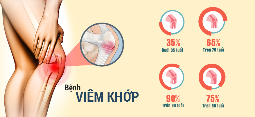 Thời tiết lạnh, giao mùa dễ làm bệnh xương khớp tái phát