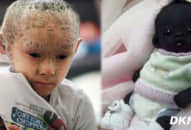 10 đứa trẻ kỳ lạ khiến bạn không thể tin các bé đang tồn tại trên Trái Đất, #9 chân, tay mọc ở bụng