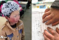 Đây là số tiền mà cậu bé tóc đóng băng, da tay nứt nẻ ở Trung Quốc được hỗ trợ, nhìn mà ấm lòng