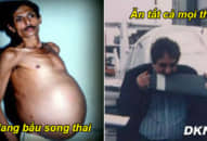 5 dị nhân của thế giới, không ngờ đàn ông cũng có thể mang thai, 1 người là người Việt