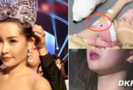 Hoa hậu Đại Dương nhập viện khẩn cấp vì bị gỡ vương miện, tình trạng hiện tại khiến người thân hoang mang