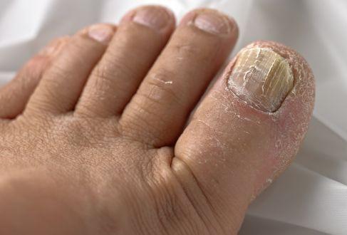 Bắt bệnh chuẩn xác qua dấu hiệu bất thường ở bàn chân mà ai cũng bỏ qua khiến sức khỏe tồi tệ hơn.