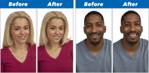 Chàng trai hí hửng bỏ 300 nghìn mua răng giả trên mạng, đến khi ướm vào miệng, dân mạng thốt lên ‘cười rụng răng là có thật!’