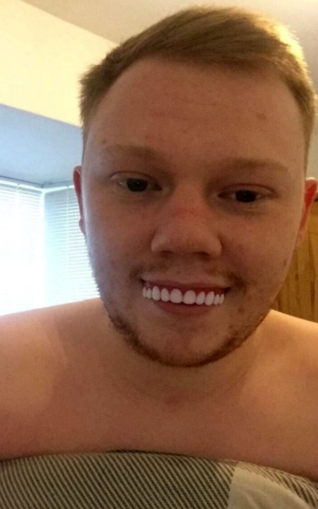 Chàng trai hí hửng bỏ 300 nghìn mua răng giả trên mạng, đến khi ướm vào miệng, dân mạng thốt lên ‘cười rụng răng là có thật!’