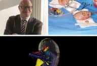 Tin vui: Mô hình thận 3D đầu tiên trên thế giới cứu sống cô gái suy thận nặng