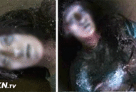 Bị vùi trong tuyết -30°C, châm kim không thủng da, nhưng vừa ‘rã đá’, cô liền nói chuyện khiến các bác sỹ bối rối