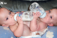 Cùng chung chân và gan, cặp song sinh lập nên kỳ tích sau phẫu thuật, bác sỹ nói tỷ lệ sống sót chỉ 1/200000