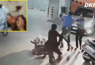 Lời kể của gia đình cụ ông bị bảo vệ chung cư đánh gãy sống mũi ở TP.HCM