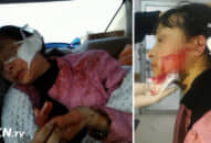 Thông tin mới nhất vụ án nữ sinh 2001 bị đánh, rạch mặt dài 14 cm ở Thanh Hóa, công an cũng rùng mình vì dã man