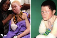 Người ‘đắt’ nhất thế giới, da đắt hơn vàng, mỗi ngày đều lo sợ bị săn bắt