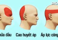 Cách massage đơn giản để chứng đau đầu ‘biến mất’ trong 5 phút mà không cần dùng thuốc