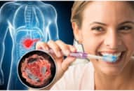 Nghi ngờ viêm nha chu có thể dẫn đến ung thư tuyến tụy?