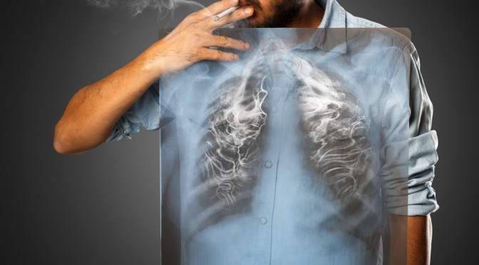 Những nguyên nhân nào dẫn đến căn bệnh ung thư phổi?