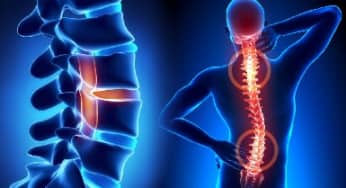 Biện pháp phòng bệnh cột sống hiệu quả