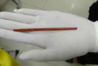 Gắp chiếc đũa dài 12 cm khỏi ‘cậu nhỏ’ bệnh nhân