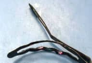 Bé 12 tuổi nuốt kẹp tóc gây thủng đường tiêu hóa