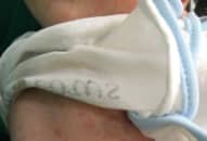 Bé trai ở Tuyên Quang chào đời mới 10 ngày đã bị thủy đậu