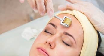 Hậu quả của phương pháp lăn kim trẻ hóa da mặt chị em cần phải biết