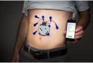 Hiệu quả đạt được khi dùng thiết bị đeo IoT chẩn đoán các bệnh về dạ dày