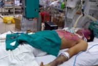 Dùng sai thuốc trị thủy đậu, thanh niên 28 tuổi nguy kịch