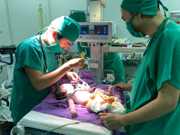 Em bé chào đời với khối thoát vị rốn
