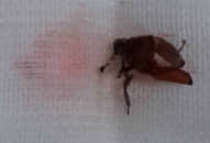 Bọ cánh cứng chui vào tai bé trai suýt làm thủng màng nhĩ