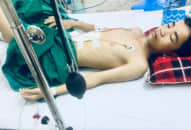 Bé trai bị vỡ lá lách do xe máy cán qua người