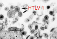 Virus cổ xưa có ‘họ hàng với HIV’ đột nhiên trỗi dậy