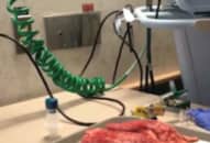 Khác biệt giữa phổi của người khỏe mạnh và người hút thuốc 20 năm