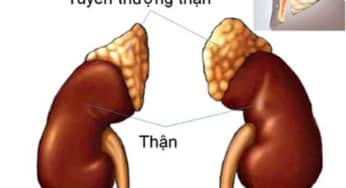 Làm thế nào để hạn chế tác dụng phụ của corticoid