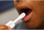 Thử nước bọt phát hiện người nhiễm HIV cực nhanh và hiệu quả