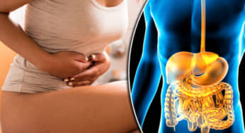Bệnh Crohn: phác đồ điều trị nội khoa, chỉ định phẫu thuật