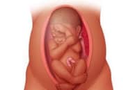 Ngôi thai ngược: Những nguy hiểm và cách chỉnh lại ngôi thai