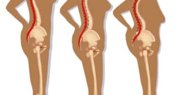 Đau cột sống do những thói quen hàng ngày mà bạn không để ý