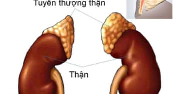 U tủy thượng thận: biến chứng nguy hiểm, phương pháp điều trị