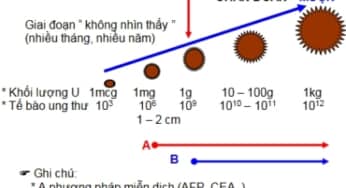 Xét nghiệm Catecholamines: quy trình thực hiện, ý nghĩa kết quả