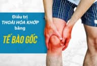 Phương pháp hiệu quả chữa thoái hóa khớp gối