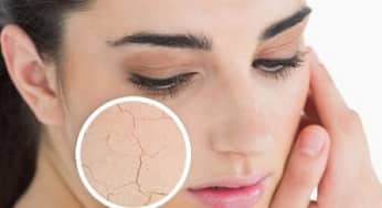 Chuyện gì sẽ xảy ra khi da bị tổn thương?