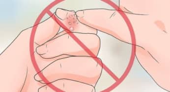 Chín mé bệnh nguy hiểm không nên chủ quan