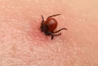 Bệnh Lyme: điều trị và những nguy hiểm khi mặc bệnh