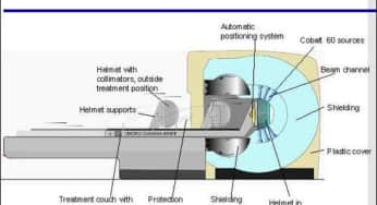 Nguyên lý hoạt động, ưu điểm, nhược điểm khi phẫu thuật bằng dao Gamma